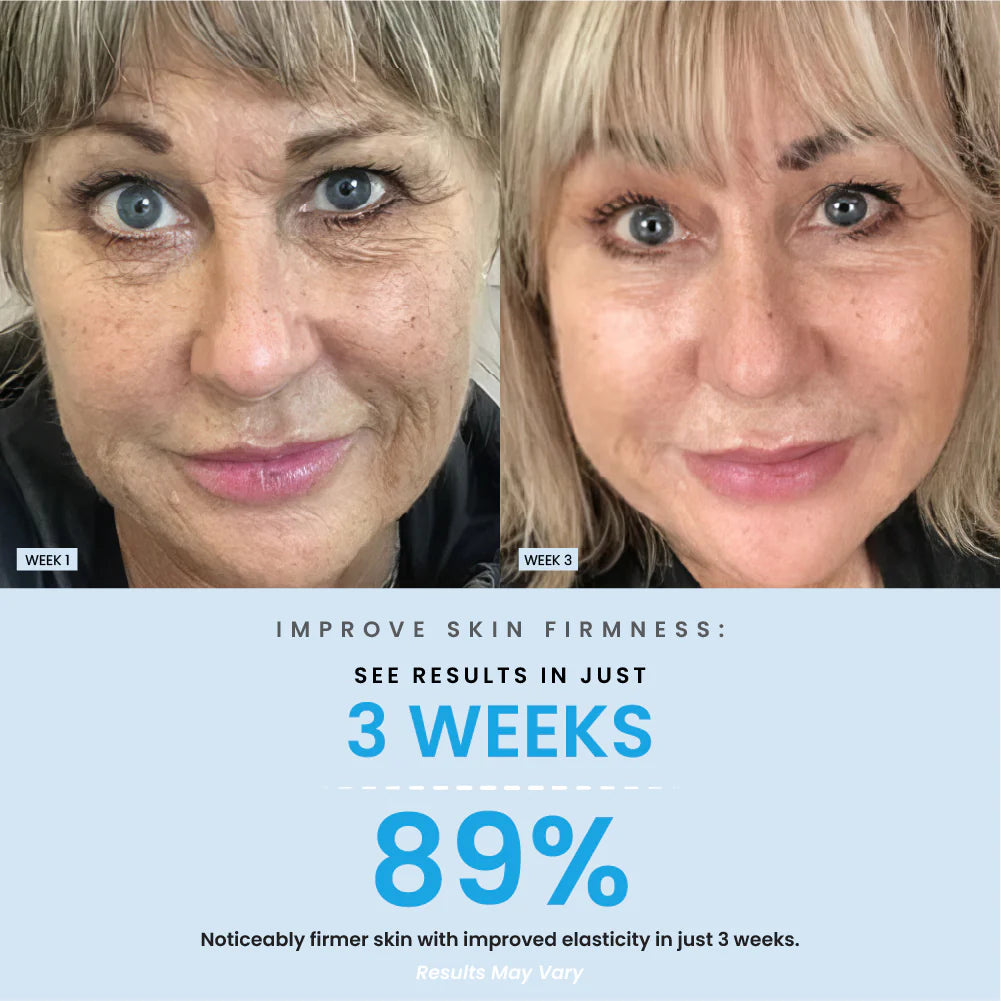 Anti-Aging Collagen Boost Daily Serum