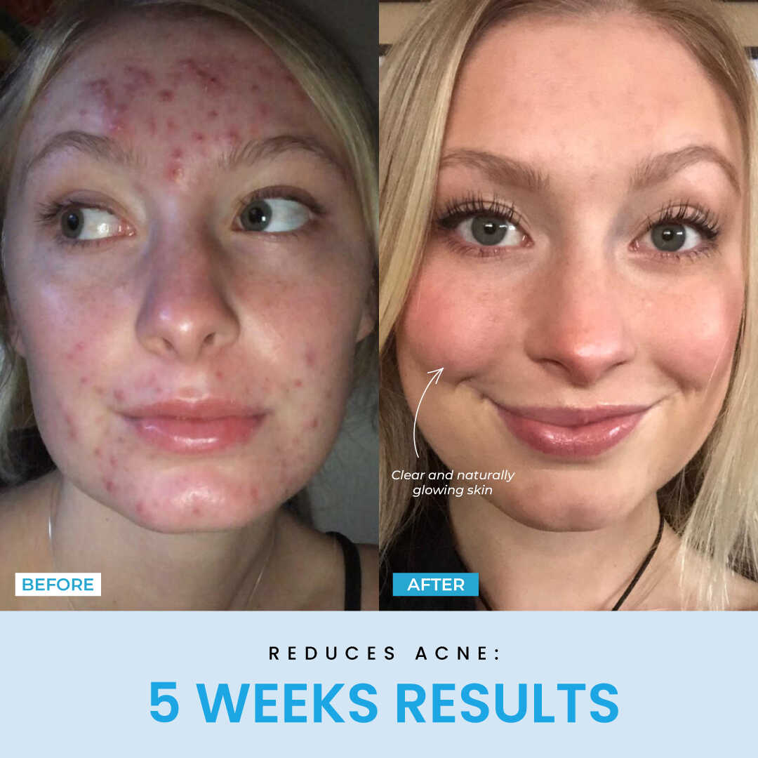 LiftLab Sculptor + Free Serum