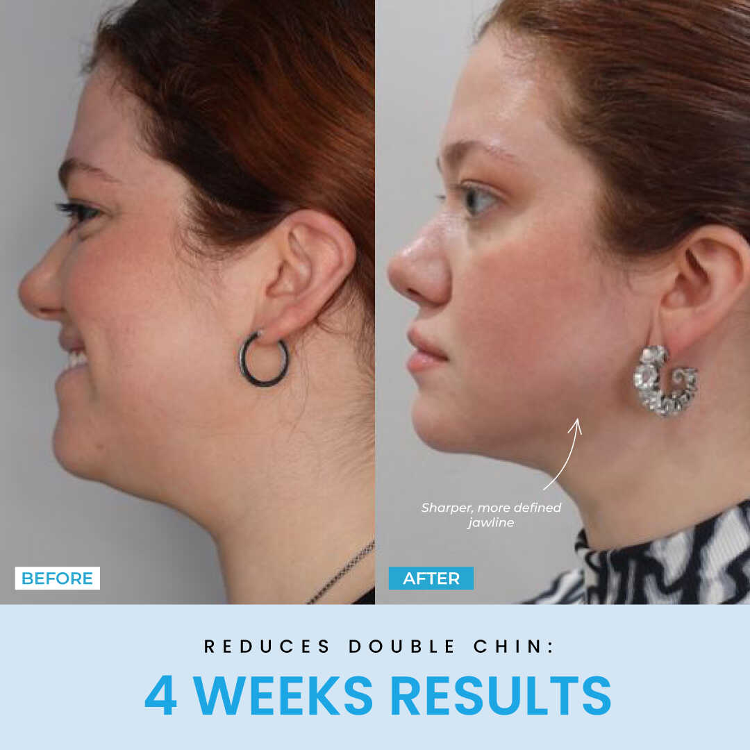 LiftLab Sculptor + Free Serum