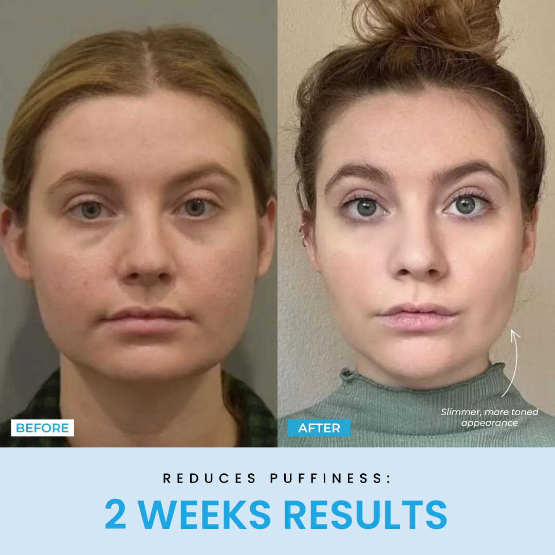 LiftLab Sculptor + Free Serum