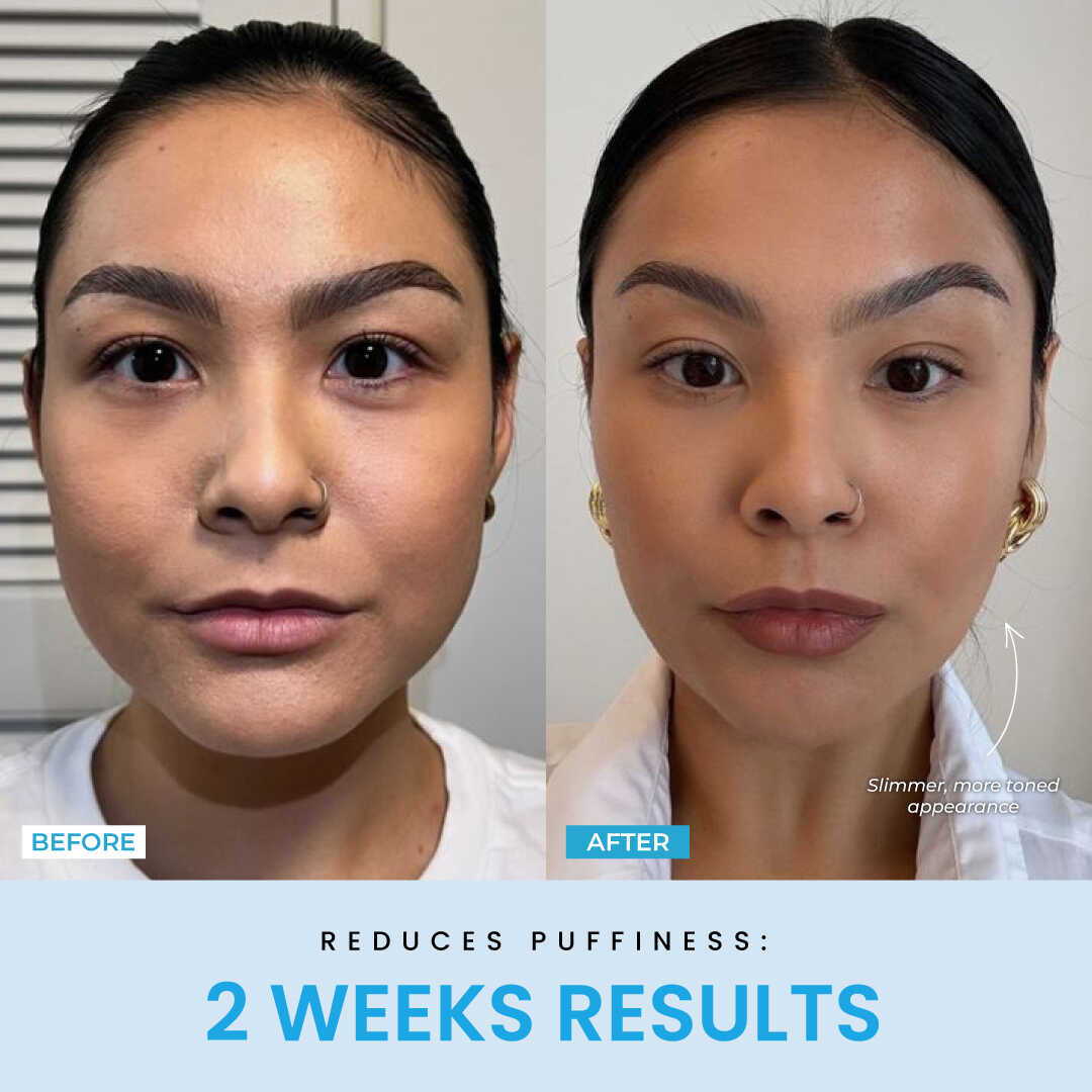 LiftLab Sculptor + Free Serum