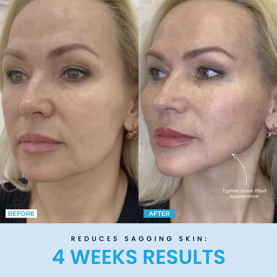 LiftLab Sculptor + Free Serum