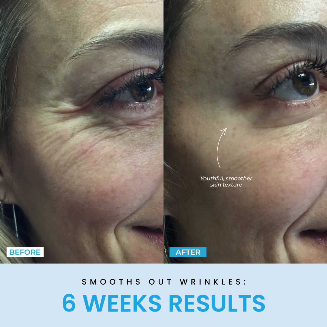 LiftLab Sculptor + Free Serum