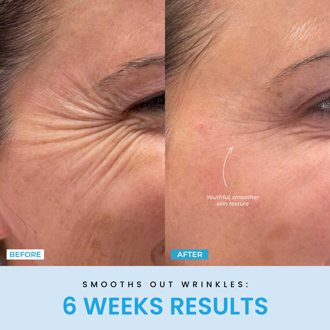 LiftLab Sculptor + Free Serum